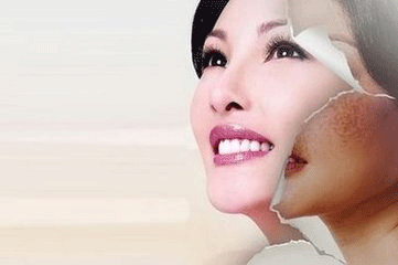 产后如何祛斑