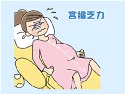 产后出血的原因及如何预防产后出血