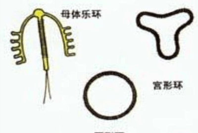 上环好吗