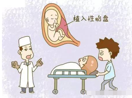 胎盘植入的原因是什么怎么预防