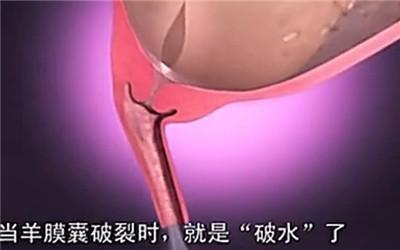 顺产分娩全过程