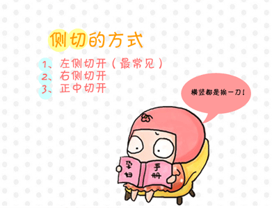 顺产都要侧切吗顺产侧切注意事项